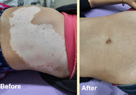 skin specialist in pune