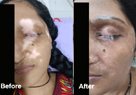 skin specialist in pune