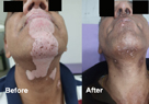 skin specialist in pune