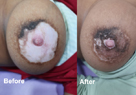 skin specialist in pune