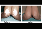 skin specialist in pune